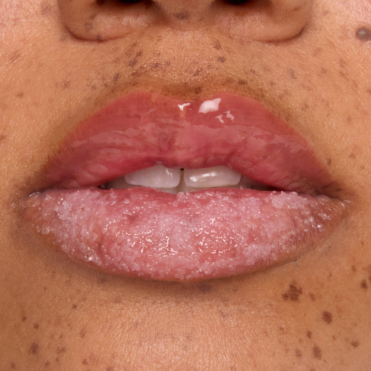 Glossy lips buffed with a candy cane sugar scrub while a hydrating mask coats the top lip, showcasing Colourpop Merriest Pout lip set in action, close-up on freckled skin to highlight smooth, exfoliated results.